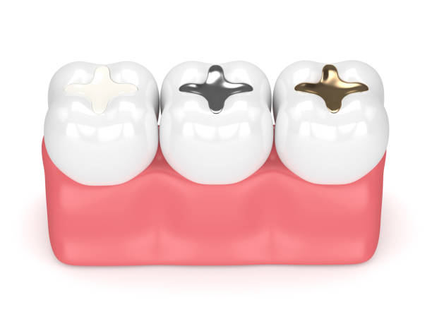 best dental clinic for cosmetic fillings in andheri